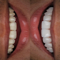 Dr. Adrian Donado - Alta Estética Dental y Armonización Orofacial