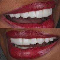 Dr. Adrian Donado - Alta Estética Dental y Armonización Orofacial