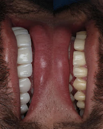Dr. Adrian Donado - Alta Estética Dental y Armonización Orofacial