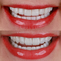 Dr Jorge Estrada - Sonrisa Deseada
