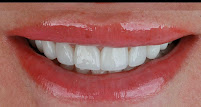 Dr Jorge Estrada - Sonrisa Deseada