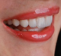 Dr Jorge Estrada - Sonrisa Deseada