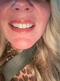 Kriebel Dental