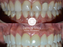 Clínica Dental Vital