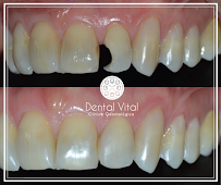 Clínica Dental Vital