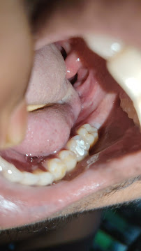 Dr Wong Dental Clinic (Bukit Indah JB)