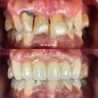 Abby Dental Clinic Southkey (Certified Invisalign Platinum Elite Provider)