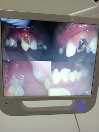 Klinik Pergigian Avisienna - Scaling, Teeth Whitening, Veneer, Aligner & Braces Larkin
