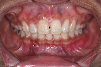 Klinik Pergigian Avisienna - Scaling, Teeth Whitening, Veneer, Aligner & Braces Larkin