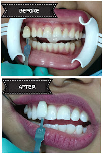 Li Dental Clinic - Gigichun JB