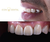 Icon Dental Kepong ( Invisalign Diamond Provider , Veneers, Implant)