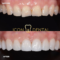 Icon Dental Kepong ( Invisalign Diamond Provider , Veneers, Implant)