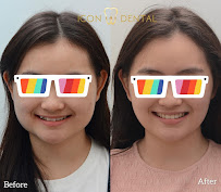 Icon Dental Kepong ( Invisalign Diamond Provider , Veneers, Implant)