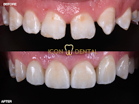 Icon Dental Kepong ( Invisalign Diamond Provider , Veneers, Implant)