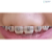 Metro Perdana Dental Clinic - Kepong (Invisalign Diamond Provider)