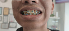 Klinik Gigi SmileStudio, Sri Rampai - Braces, Aligners, Whitening, Family Dental Care