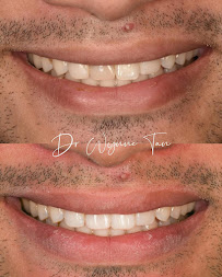 JY Dental Clinic Bandar Sri Damansara(Est. 2017)Relocated to 34-G (Invisalign, Braces, Implants)