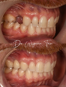 JY Dental Clinic Bandar Sri Damansara(Est. 2017)Relocated to 34-G (Invisalign, Braces, Implants) in Kuala Lumpur