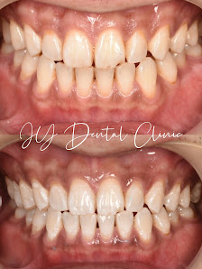 JY Dental Clinic Bandar Sri Damansara(Est. 2017)Relocated to 34-G (Invisalign, Braces, Implants)