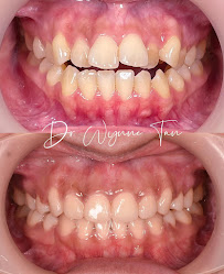 JY Dental Clinic Bandar Sri Damansara(Est. 2017)Relocated to 34-G (Invisalign, Braces, Implants)