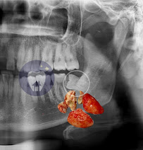 JY Dental Clinic Bandar Sri Damansara(Est. 2017)Relocated to 34-G (Invisalign, Braces, Implants)