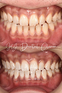 JY Dental Clinic Bandar Sri Damansara(Est. 2017)Relocated to 34-G (Invisalign, Braces, Implants)