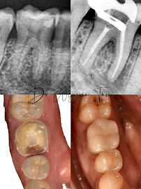 JY Dental Clinic Bandar Sri Damansara(Est. 2017)Relocated to 34-G (Invisalign, Braces, Implants)