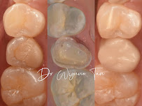 JY Dental Clinic Bandar Sri Damansara(Est. 2017)Relocated to 34-G (Invisalign, Braces, Implants)