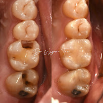 JY Dental Clinic Bandar Sri Damansara(Est. 2017)Relocated to 34-G (Invisalign, Braces, Implants)