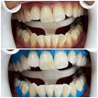 Boulevard Dental Clinic (INVISALIGN PROVIDER)