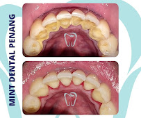 Mint Dental