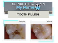 KLINIK PERGIGIAN MY HOME