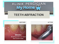 KLINIK PERGIGIAN MY HOME