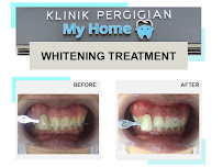 KLINIK PERGIGIAN MY HOME