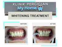 KLINIK PERGIGIAN MY HOME