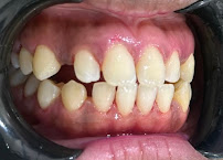 Klinik Pergigian VN Smile| Dental Clinic Butterworth| Penang