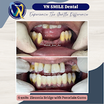 Klinik Pergigian VN Smile| Dental Clinic Butterworth| Penang