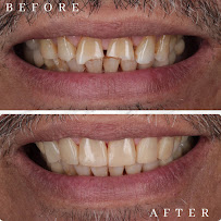 abc dental raja uda | abc 牙医诊所 | klinik pergigian abc dental（Butterworth)