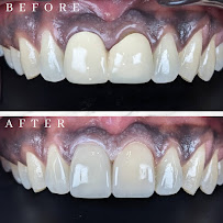 abc dental raja uda | abc 牙医诊所 | klinik pergigian abc dental（Butterworth)