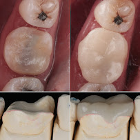 abc dental raja uda | abc 牙医诊所 | klinik pergigian abc dental（Butterworth)