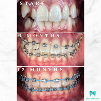 abc dental raja uda | abc 牙医诊所 | klinik pergigian abc dental（Butterworth)