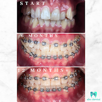 abc dental raja uda | abc 牙医诊所 | klinik pergigian abc dental（Butterworth)