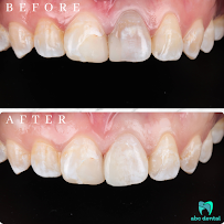 abc dental raja uda | abc 牙医诊所 | klinik pergigian abc dental（Butterworth)