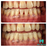 abc dental raja uda | abc 牙医诊所 | klinik pergigian abc dental（Butterworth)