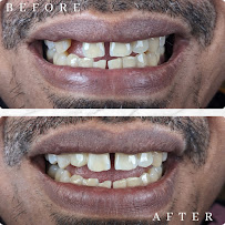 abc dental raja uda | abc 牙医诊所 | klinik pergigian abc dental（Butterworth)