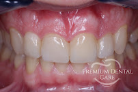 Premium Dental Care
