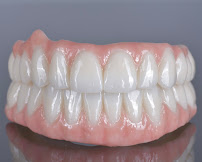 BioDent - Dental implantation