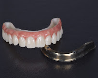 BioDent - Dental implantation