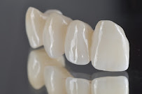 BioDent - Dental implantation