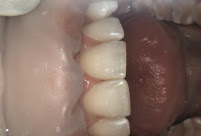 SDS - Smile Design Studio